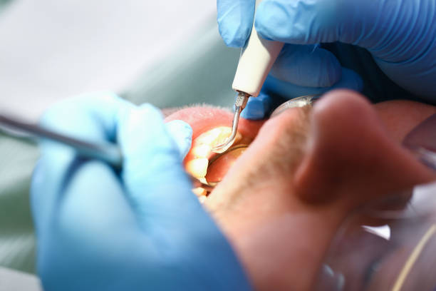 Best Emergency Tooth Extraction in Poquott, NY